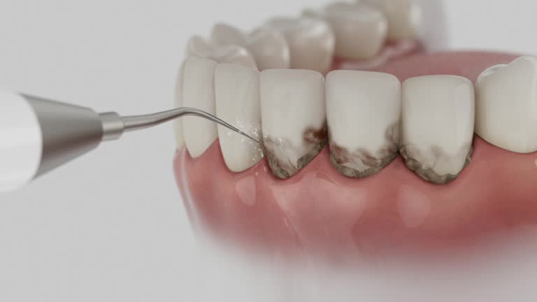 Reliable Dental contractor in Laureles, TX by Smile Center Dentistry